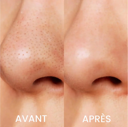 Masque anti-points noirs - Miya™